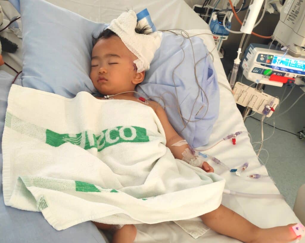Child suffered serious head injury in daycare ECE New Zealand